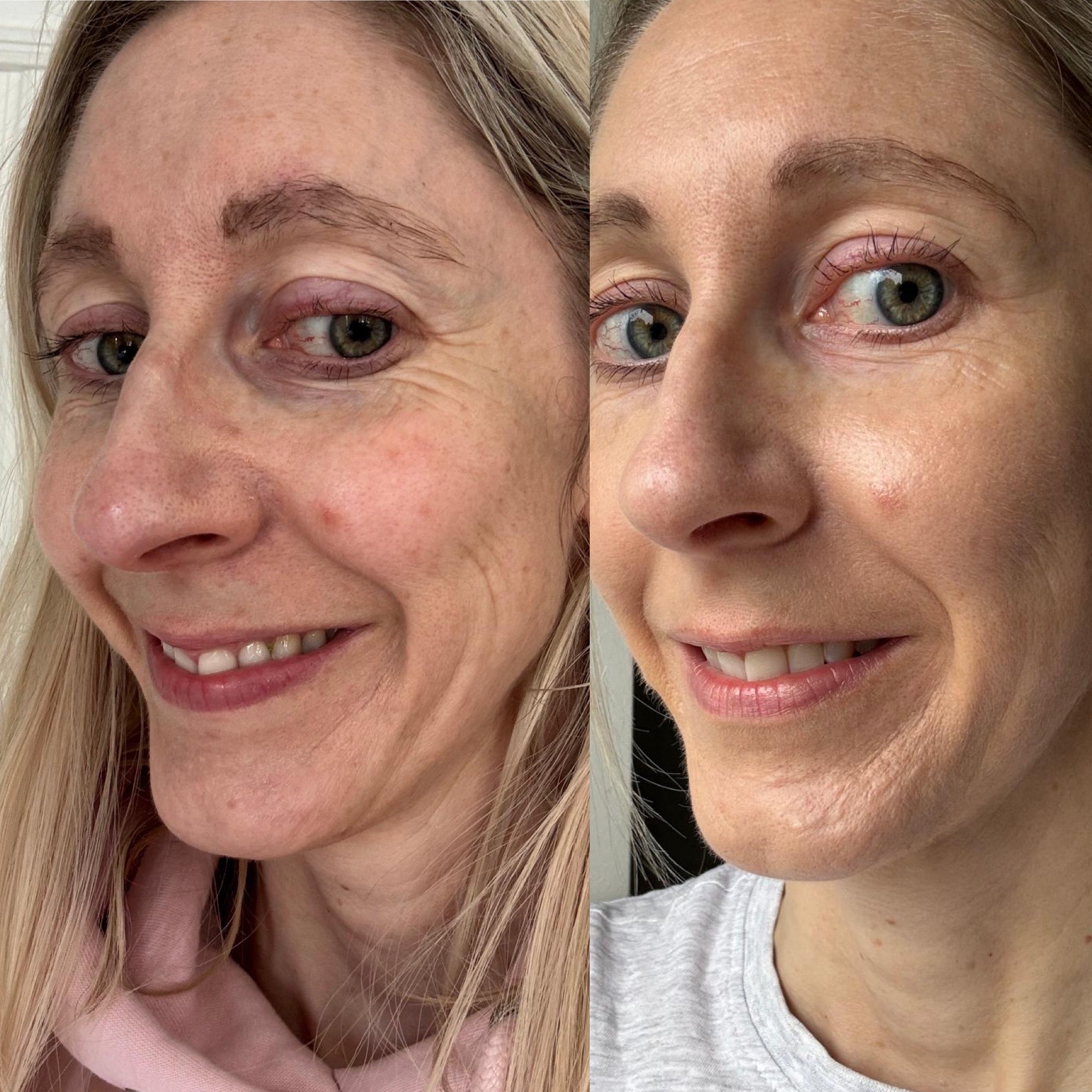 COLLAGEN PLUS LIQUID MARINE COLLAGEN