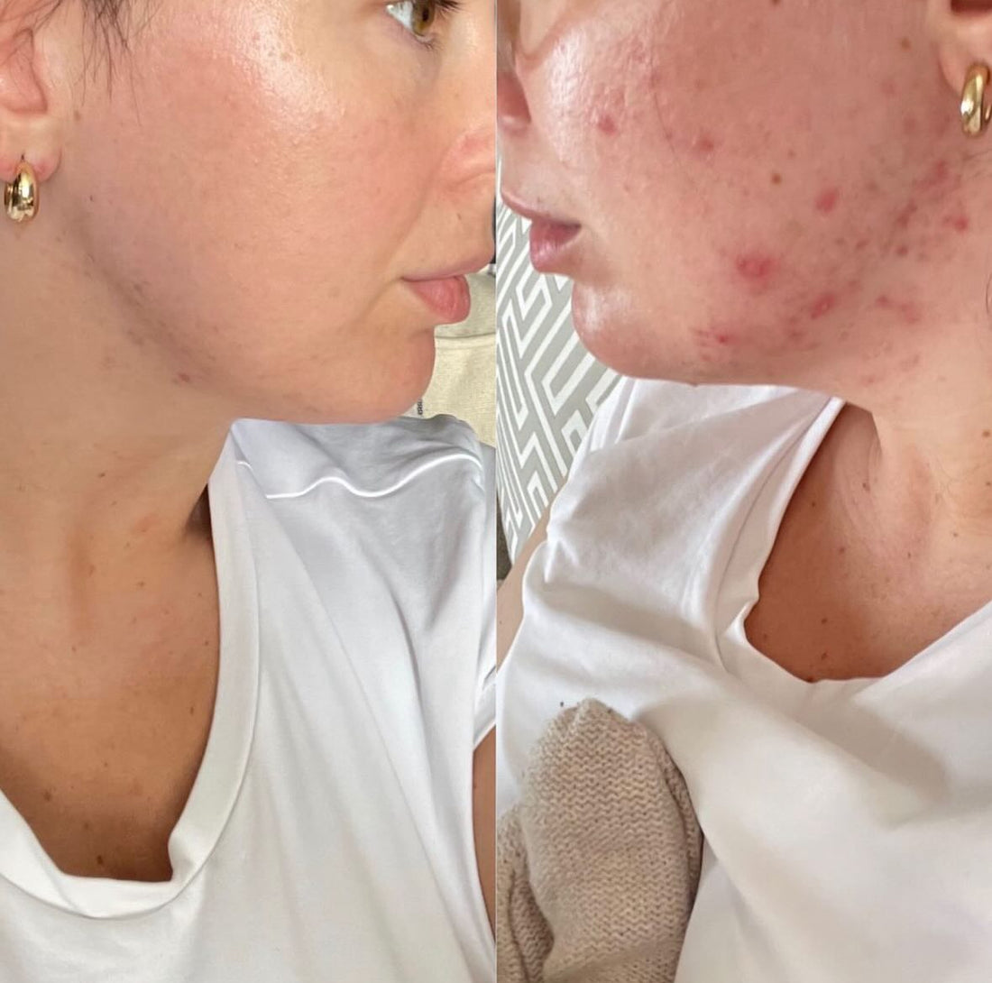 CLEAR &amp; CALM LIQUID VITAMIN SUPPLEMENT