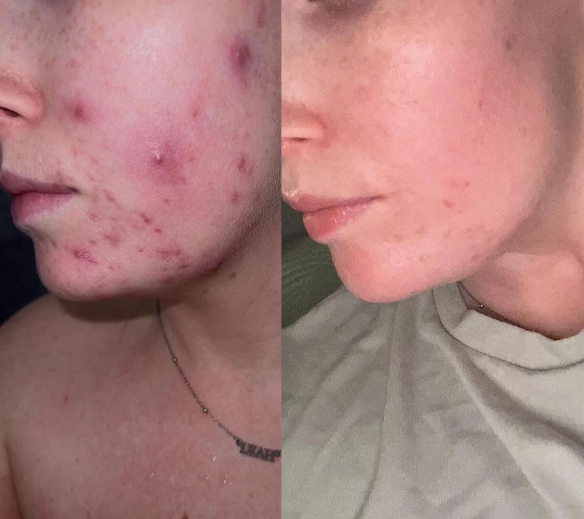 CLEAR &amp; CALM LIQUID VITAMIN SUPPLEMENT