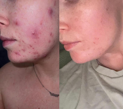 CLEAR &amp; CALM LIQUID VITAMIN SUPPLEMENT