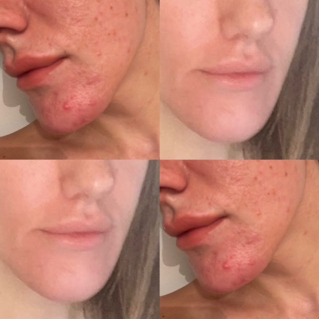 CLEAR &amp; CALM LIQUID VITAMIN SUPPLEMENT