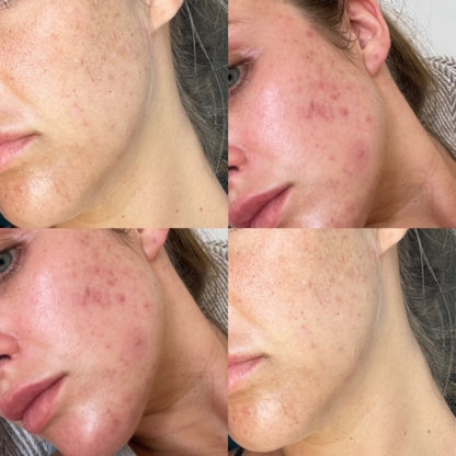 CLEAR &amp; CALM LIQUID VITAMIN SUPPLEMENT