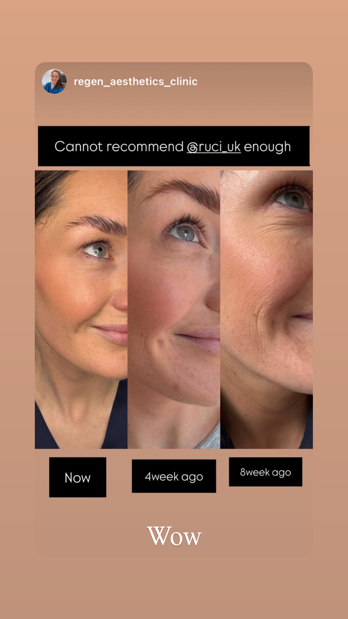 COLLAGEN PLUS LIQUID MARINE COLLAGEN