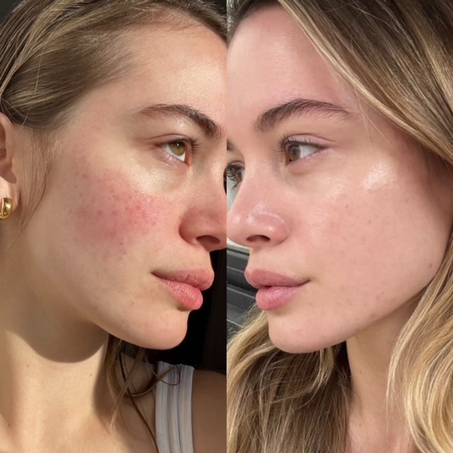 ILLUMINATE &amp; HYDRATE  LIQUID VITAMIN SUPPLEMENT