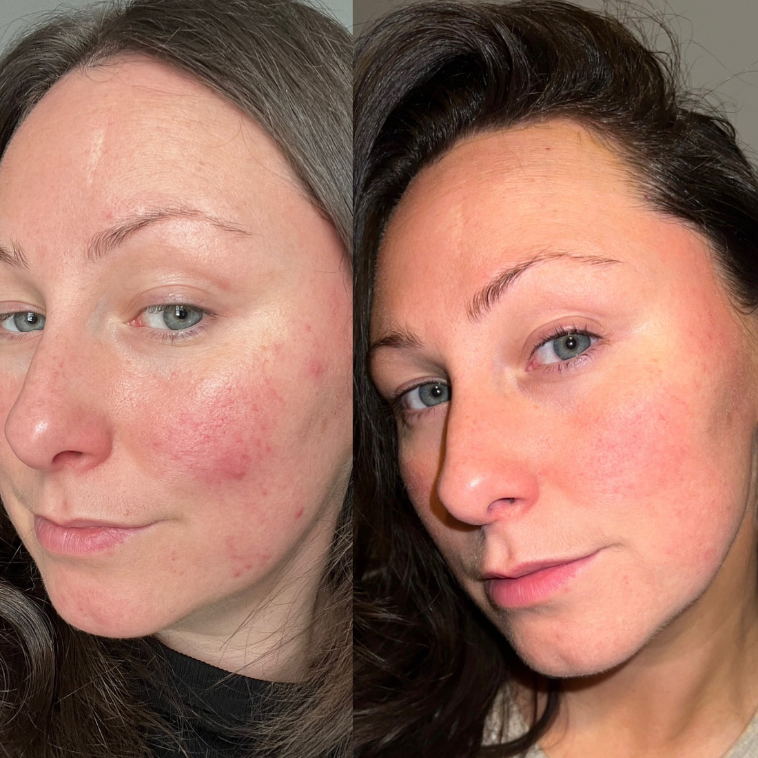 REJUVENATE &amp; FIRM LIQUID VITAMIN SUPPLEMENT