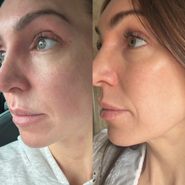 ILLUMINATE &amp; HYDRATE  LIQUID VITAMIN SUPPLEMENT